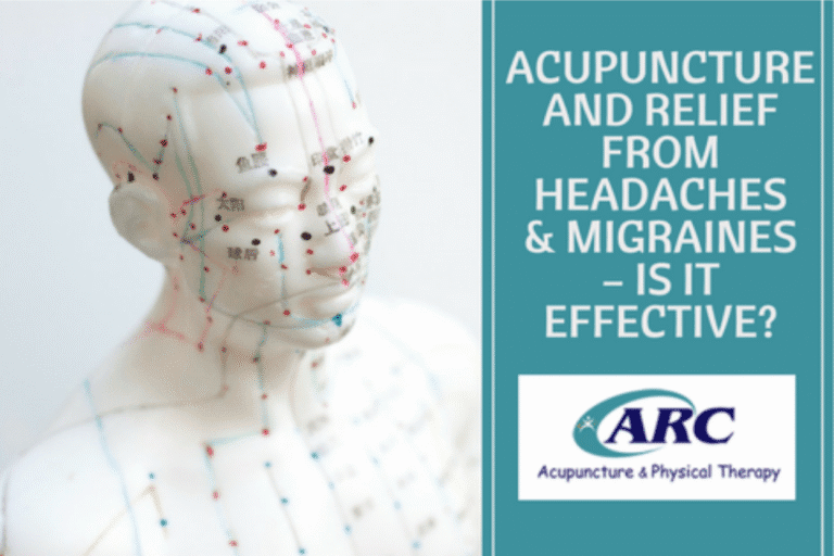 Acupuncture and Relief from Headaches and Migraines – Is It Effective?