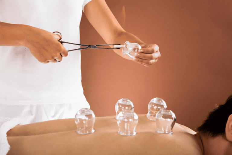 Boost Your Recovery Naturally with Cupping Therapy at ARC