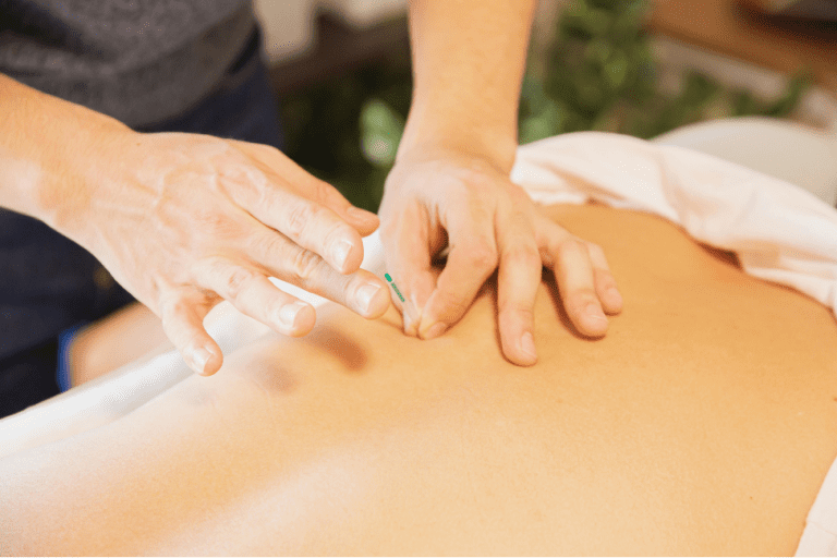 Discover the Healing Power of Acupuncture at ARC